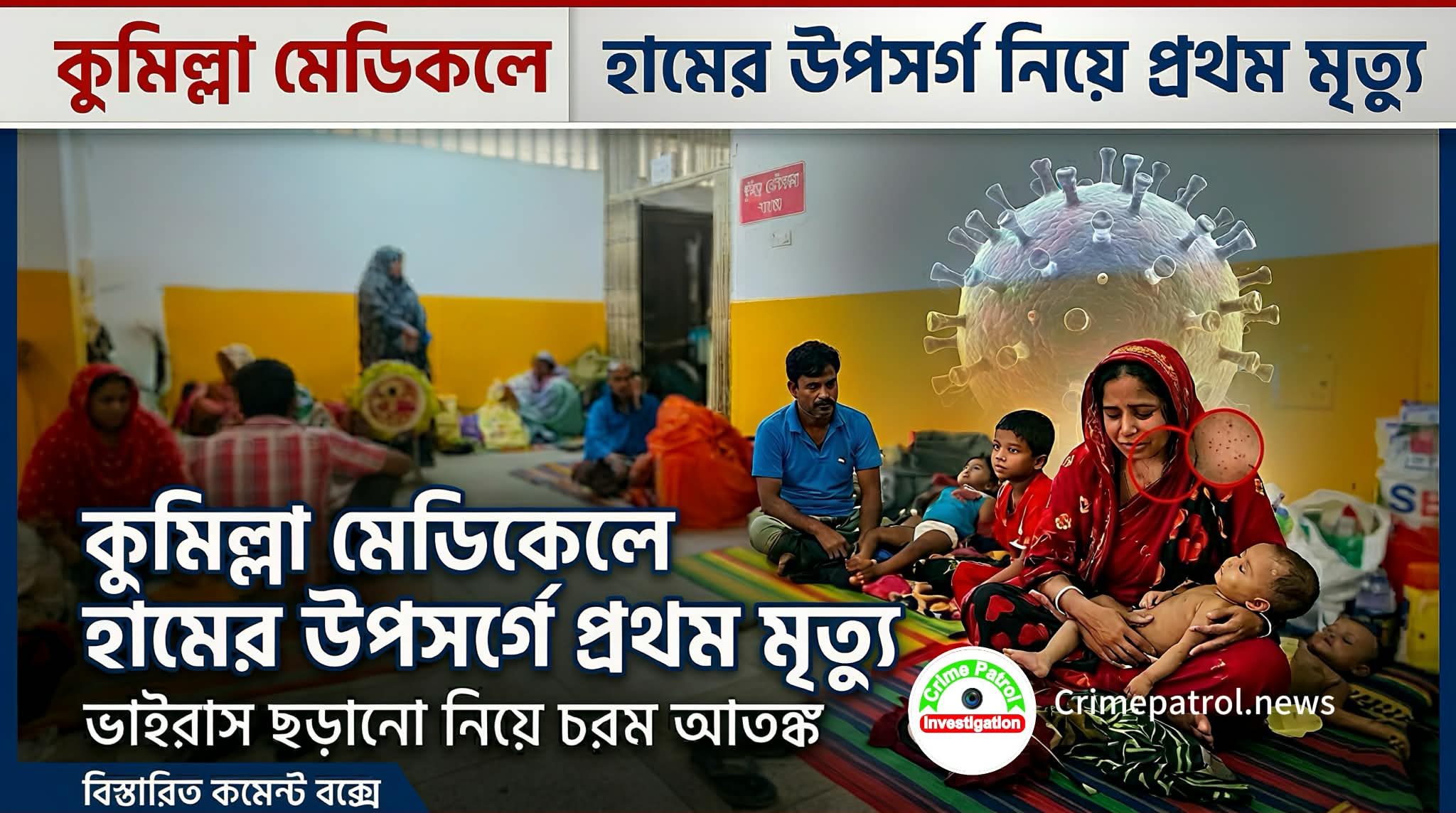 কুমিল্লায় হামের উপসর্গে রোগীর মৃত্যু: স্বাস্থ্য খাতে চরম উদ্বেগ