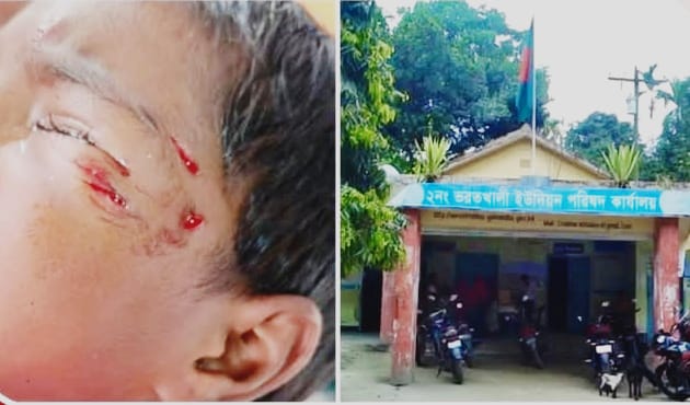 গাইবান্ধার সাঘাটায় বেওয়ারিশ কুকুরের তাণ্ডব: ২ দিনে আহত ১০, আতঙ্কে জনপদ — নেই র‌্যাবিস ভ্যাকসিন