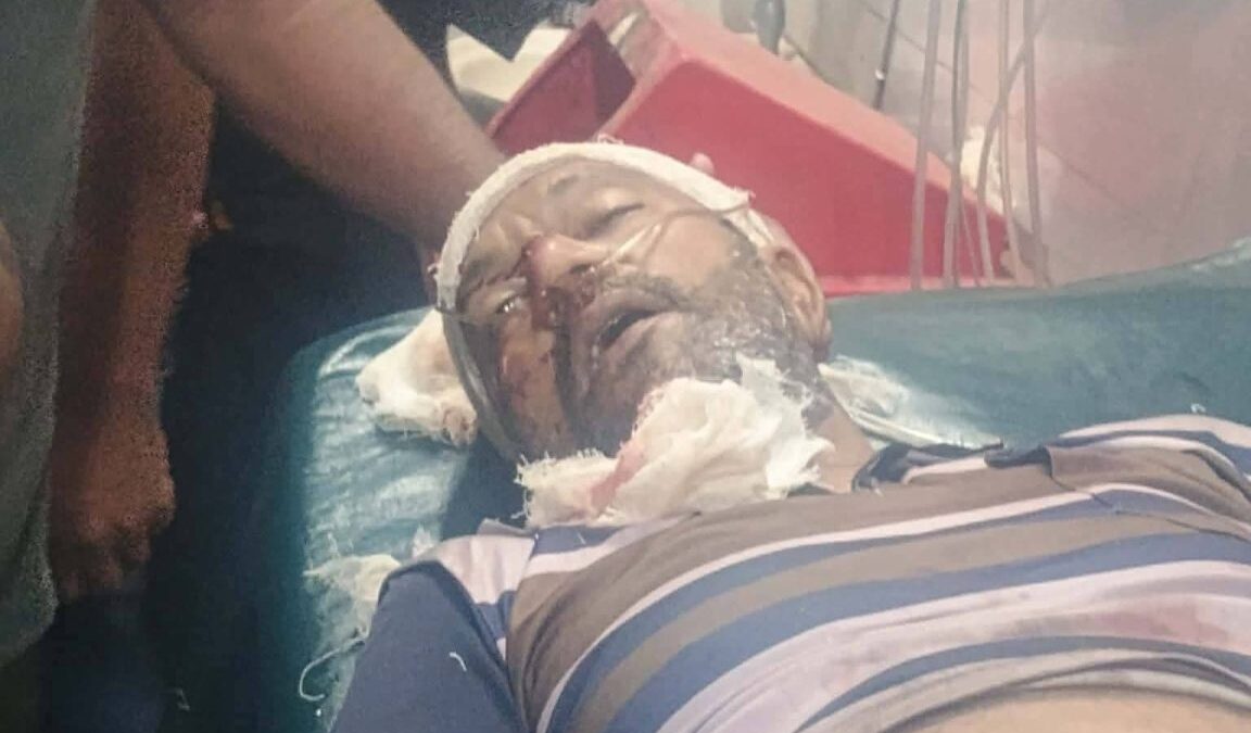কাশিয়ানীতে সড়ক দুর্ঘটনায় বাইসাইকেল আরোহী